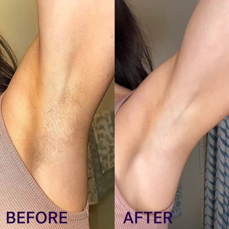 Pain Free Hair Removal Spray