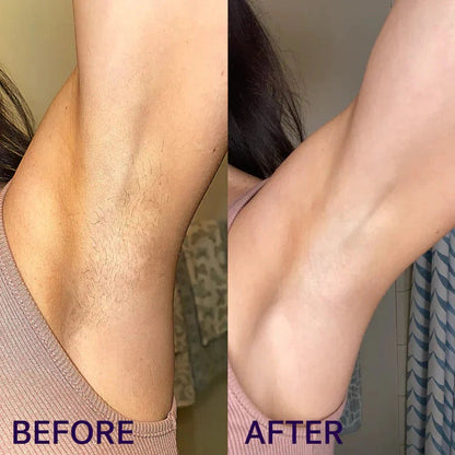 Pain Free Hair Removal Spray