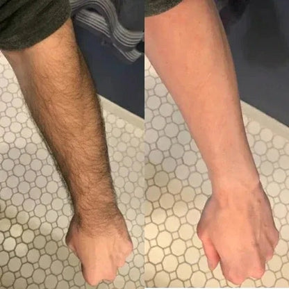 Pain Free Hair Removal Spray